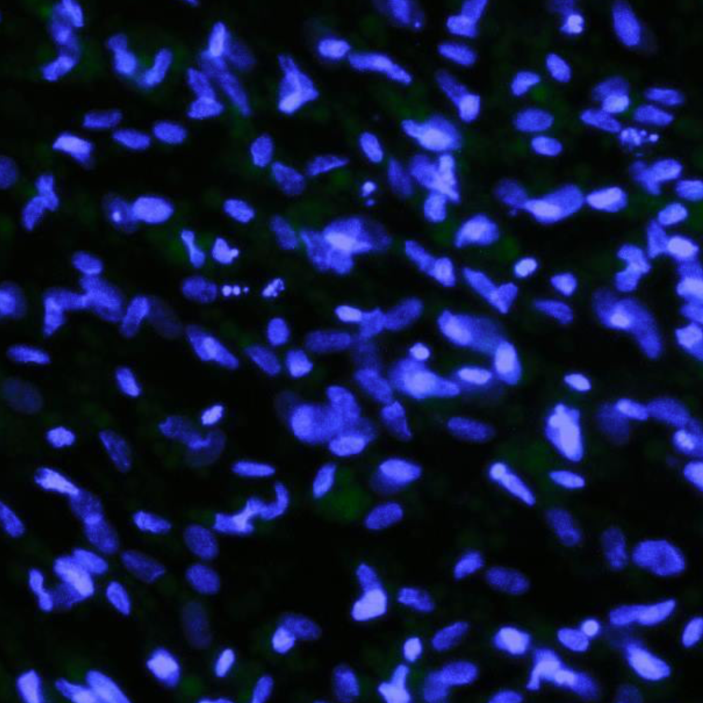 The Stem Cell Network Welcomes Two New Awardees to the SCN-RDMM Catalyst Grant Program