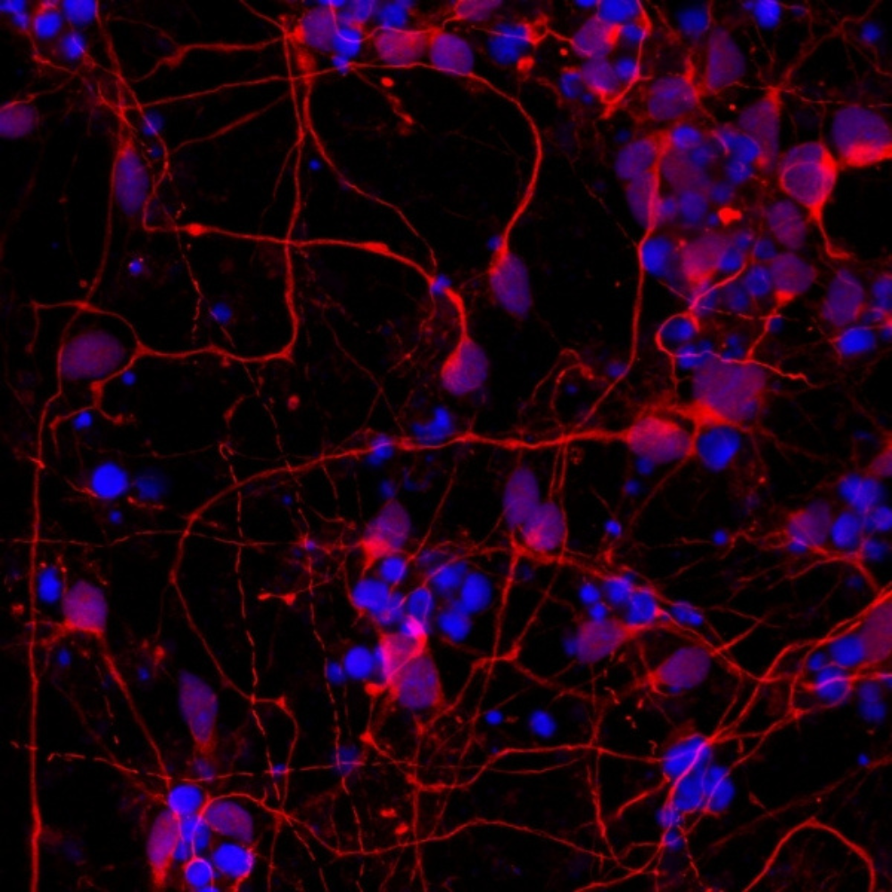 SCN-funded research team makes groundbreaking discovery, opening new doors in drug development for treatment of diseases such as Duchenne muscular dystrophy